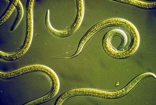 Parasitäre Nematodenwürmer im menschlichen Dünndarm